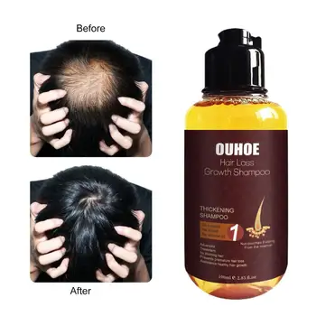 Šampon Od Gubitka Kose ne-masnu Klima Za Rast Kose Prirodni Okrepljujući Duboko Čišćenje Šampon Od Gubitka Kose Sredstva Za njegu kose